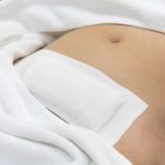 biaya operasi angkat rahim