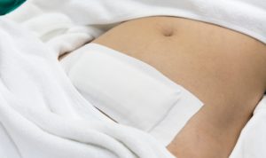 biaya operasi angkat rahim